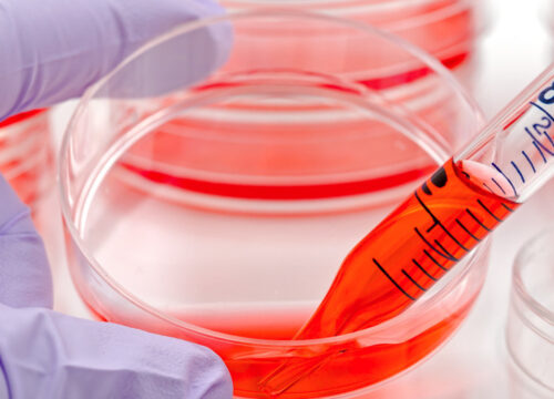 Photo of cell therapy