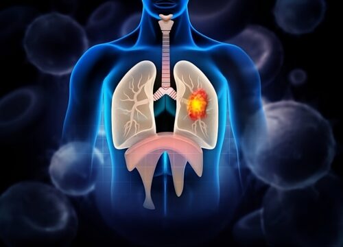 lung disease
