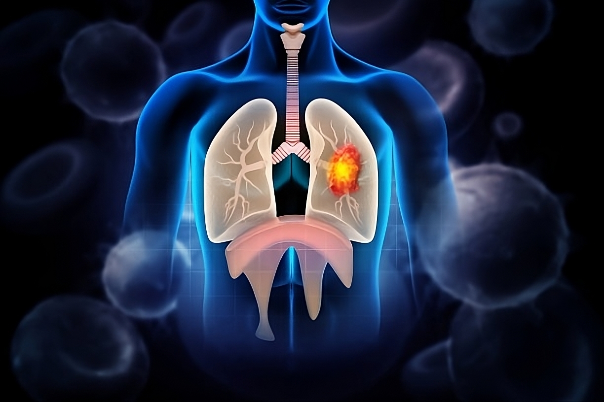 Lung diseases and lung fibrosis